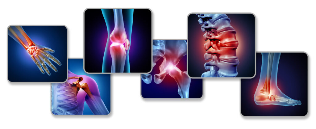 iStock 1171639646